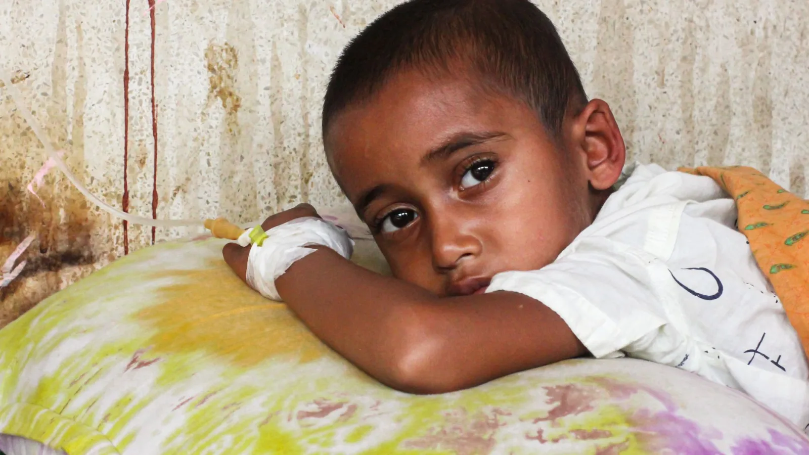 Young child resting with IV in hospital setting, showing concern.
